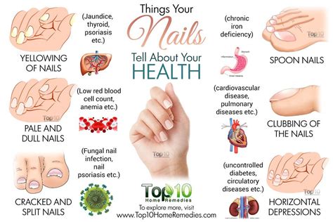 What Your Nails Say About Your Health Emedihealth Psoriasis Fungal