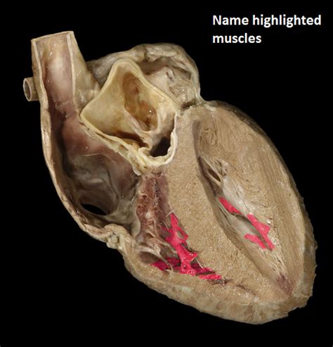 Body muscles names muscle names human muscular system yoga anatomy foot reflexology psoas muscle muscle anatomy major. heart lab Flashcards | Easy Notecards