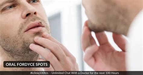 How To Get Rid Of Fordyce Spots On Your Lips
