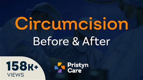 Before Vs After Laser Circumcision Surgery Youtube