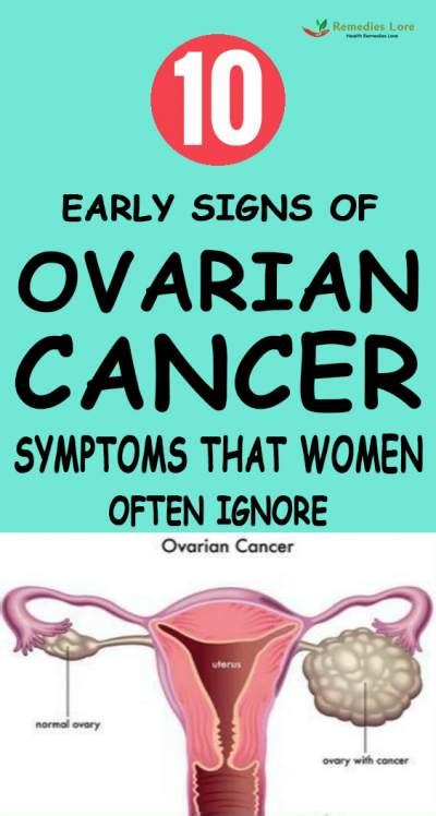 10 Early Signs Of Ovarian Cancer Symptoms That Women Often Ignore