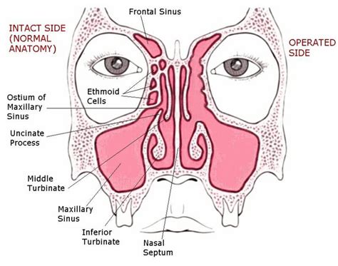 Jo Fly Labeled Nasal Cavity Anatomy Human Anatomy Nose Diagram