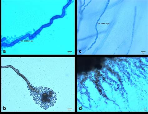 Figure 2 From Electrospinning Nanofibres Of Pullulan Extracted From