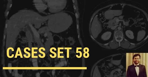 Interesting Radiology Cases 6 Spotters Set 58 Radiogyan