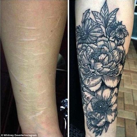 Do Tattoo Artist Hate Tattooing Over Self Harm Scars Quora