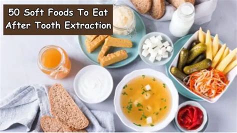 50 Soft Foods To Eat After Tooth Extraction