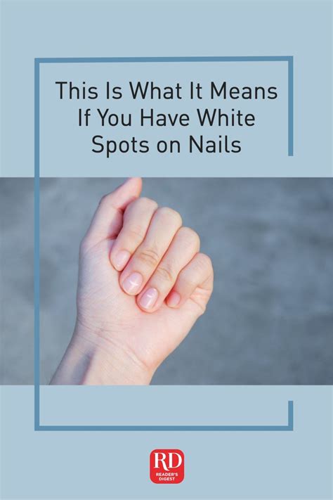 Heres What It Means If You Have White Spots On Your Nails White
