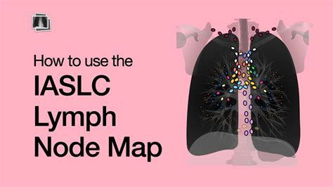 Lung Cancer Staging With The Iaslc Lymph Node Map Youtube
