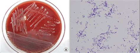 A Colonial Morphology Of Gram Positive Bacilli On A Blood Agar Plate