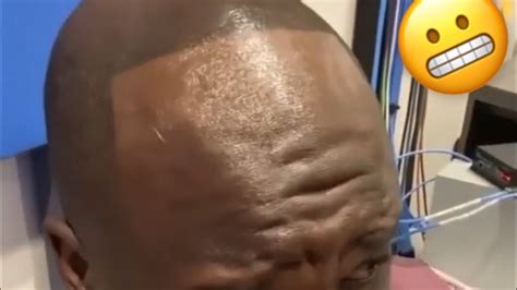 Shaq Showing Off His New Hairline 😬 Youtube