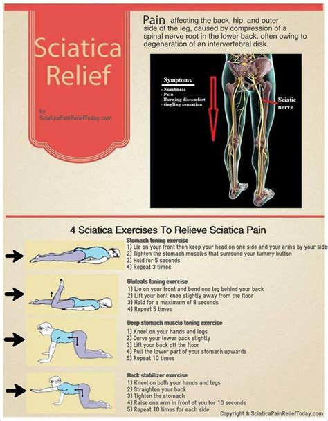 How To Cure Sciatica Pain Cares Healthy