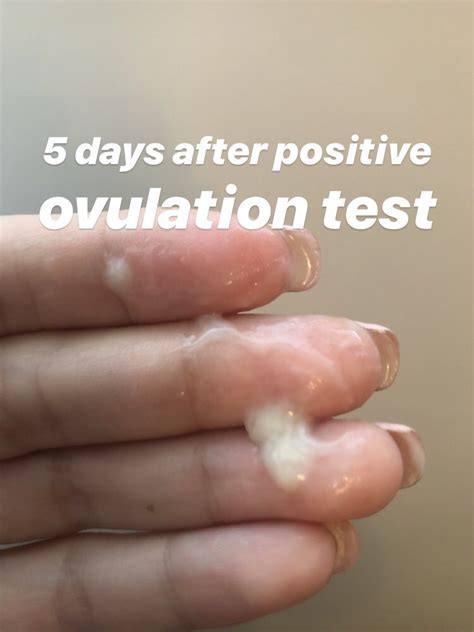 Cervical Mucus During Ovulation All You Need To Know