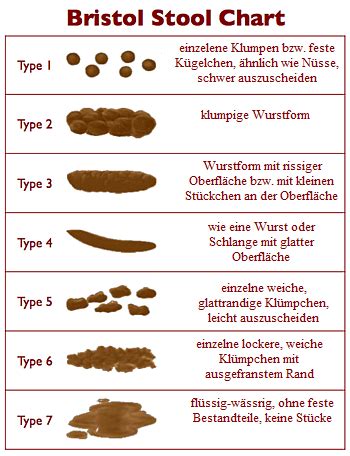 Die informationen, die man aus diesen. Hämorrhoiden und Co.: Die Bristol-Stuhlformen-Skala