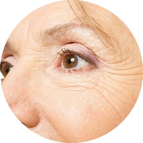 Fine Lines And Wrinkles Yhvh Medical Clinic