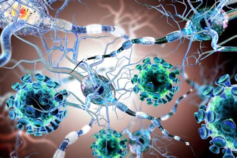 Es una enfermedad de la motoneurona o neurona motora dado a un alteración grave en su estructura. Esclerosis lateral amiotrófica: Qué es, causas, características y más