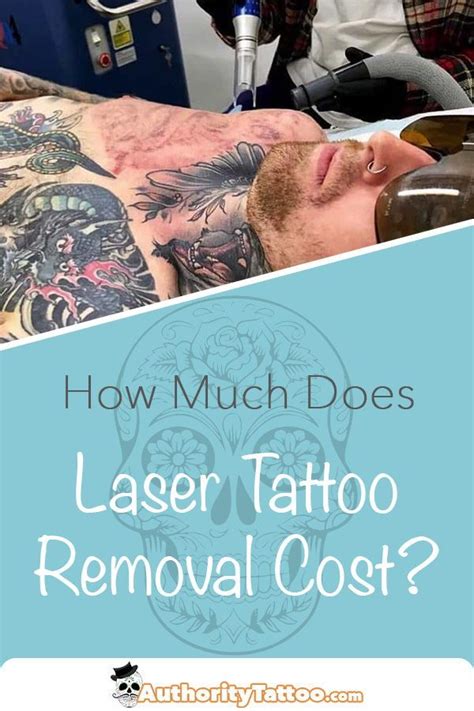 Everything You Need To Know About Laser Tattoo Removal Prices And How
