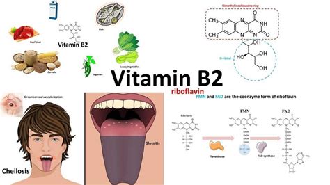 Vitamin B Deficiency Diseases