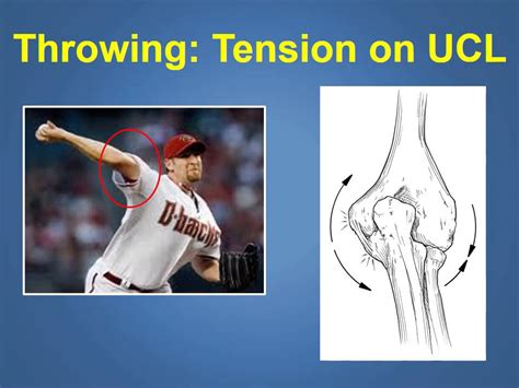 Ulnar Collateral Ligament Injuries And Treatment Explained By A Phoenix