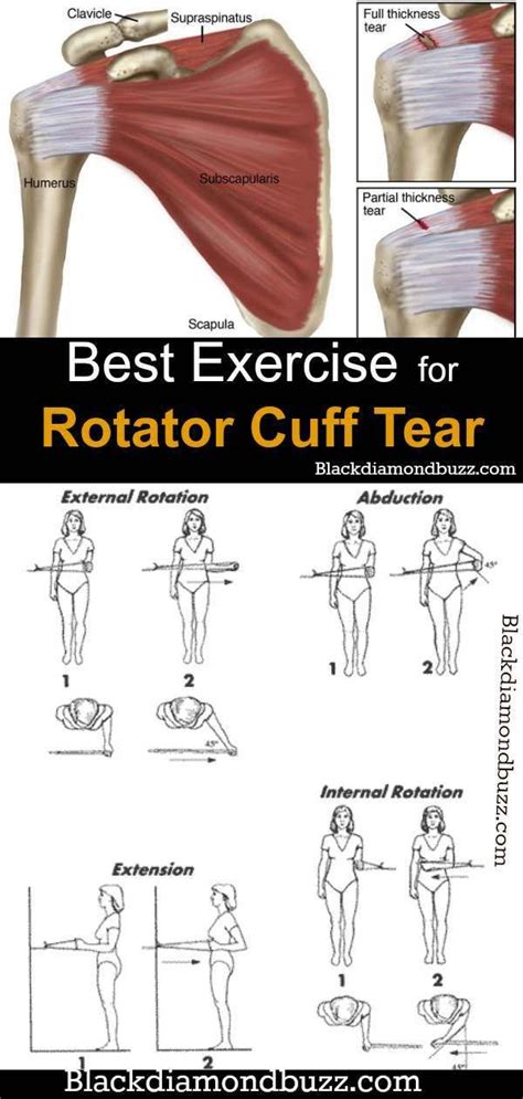 Best Exercises For Sore Rotator Cuff Exercisewalls