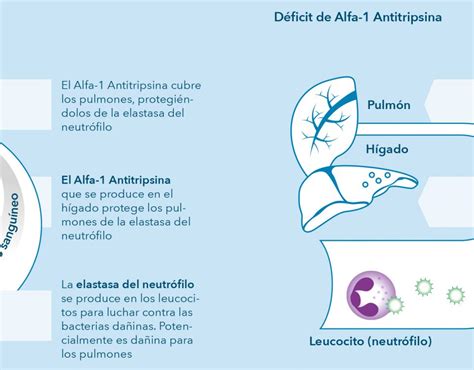 Alfa 1 Antitripsina Beaniella