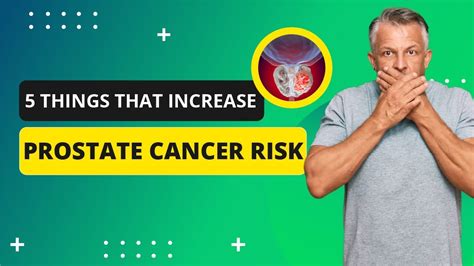 Prostate Cancer What Are The Risk Factors Top Youtube