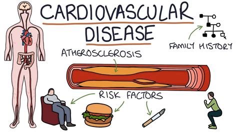 Cardiovascular Disease Symptoms Causestypes And Risk Factors