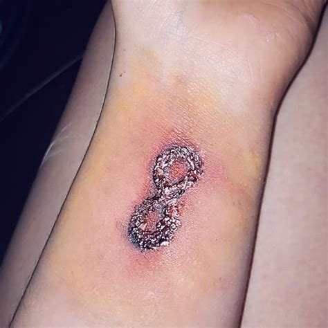 Tips To Avoid A Tattoo Infection Proper Aftercare Treatment