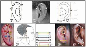 The Human Ear The Auricle Part 2 Hearing Health Technology Matters