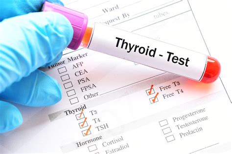 Weight Loss And Hypothyroidism