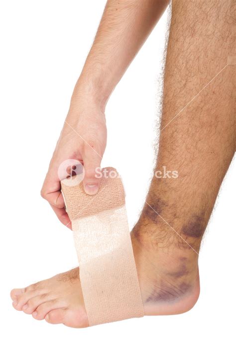 Bandaging A Sprained Ankle Royalty Free Stock Image Storyblocks