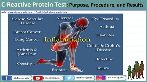 Crp was so named because it was first identified as a substance in the serum of patients with acute inflammation that reacted with the somatic 'c' carbohydrate antigen of pneumococcus. C-Reactive Protein Test: Purpose, Procedure, and Results ...
