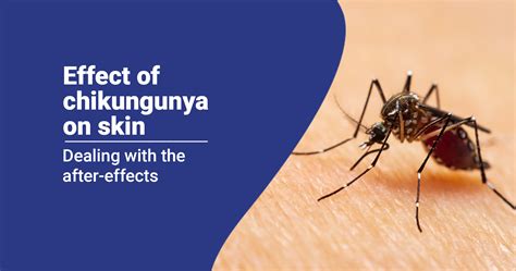 Chikungunya Effect On Skin What You Need To Know