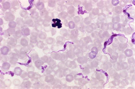 Gambar Blood Parasites Trypanosomiasis Gatotkaca Search