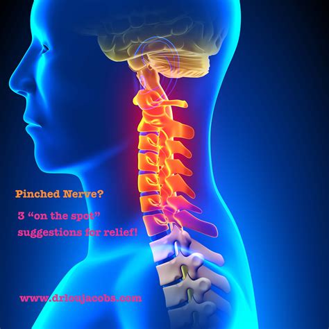 Pinched Nerve In Your Neck Try 3 Things On The Spot Once The Pain