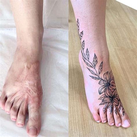 a guide on tattooing over scars self tattoo
