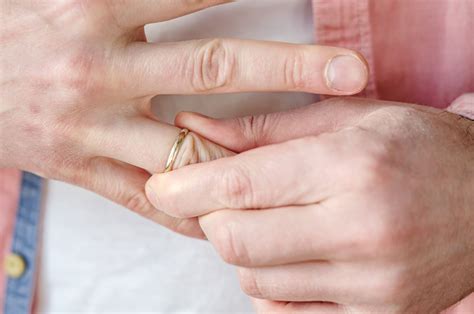 Doctor Reveals The Key To Removing A Ring Stuck On Your Finger Visit The