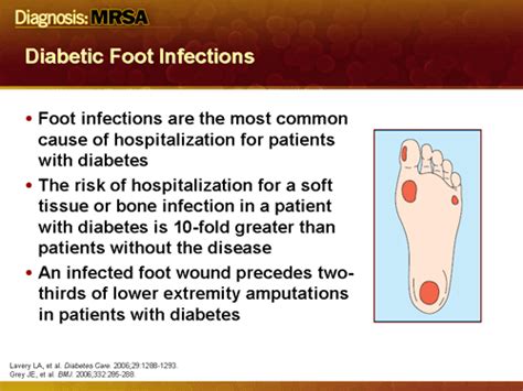Diabetic Foot Infection Slides With Transcript