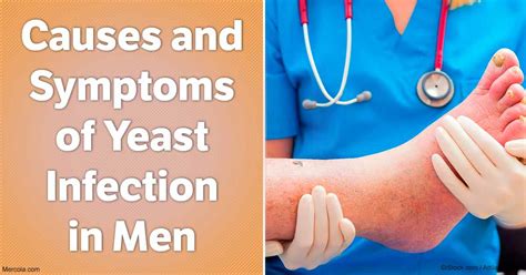 Causes And Symptoms Of Yeast Infection In Men
