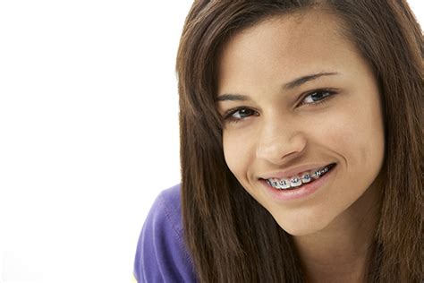Why Get Braces Dr Mark Nalbandian Wired Orthodontics
