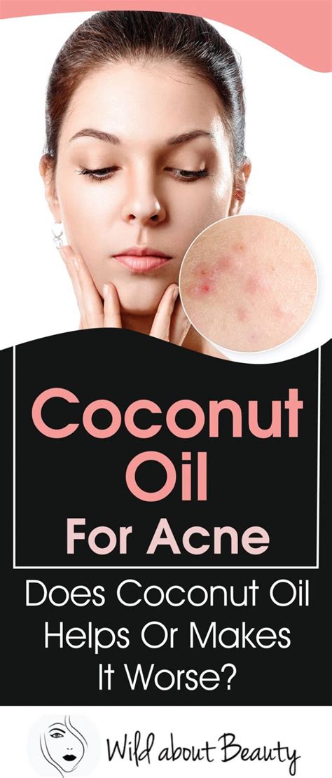 Coconut Oil For Acne Does Coconut Oil Helps Or Makes It Worse