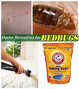 Photos of Home Remedies Bugs