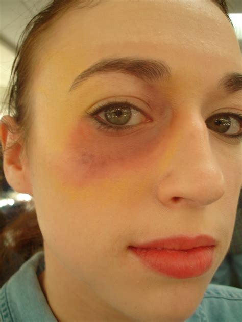 Make Up Elisa Bruises And Black Eyes