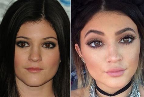 kylie jenner lip injections always interesting what you can find when you type in plastic