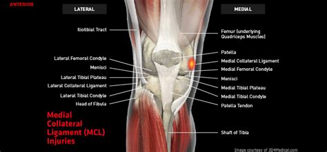 Medial Collateral Ligament Mcl Injuries Thermoskin Supports And