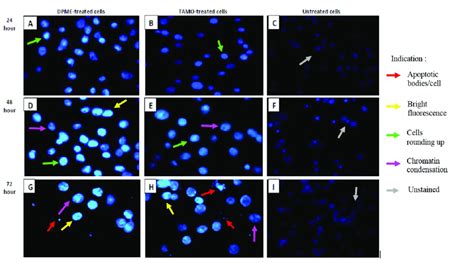 Nuclear Staining Of MCF 7 Cells By Hoechst 33258 Dye Cells Were Left