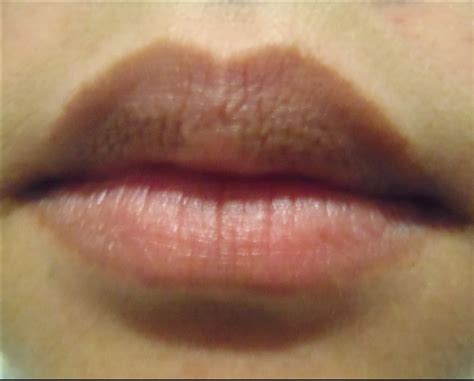 Aspiremua Beauty Tip 3 Natural Rememdies To Lighten Dark Lips