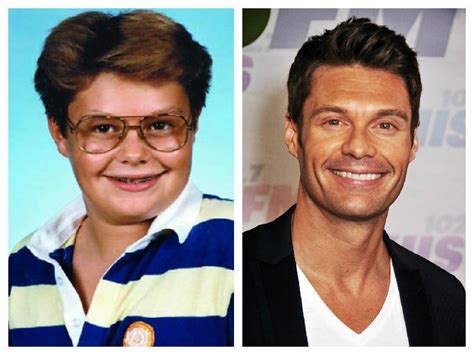 15 Hot Celebrities Who Grew Up As The Ugly Duckling