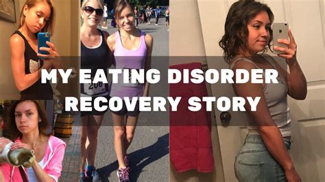 My Eating Disorder Recovery Story Youtube