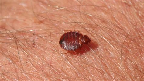 What Do Bed Bugs Look Like Bed Bug Bites Bed Bug Pictures Ph