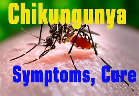 Chikungunya Fever Virus Symptoms Cure Whatsapp Images